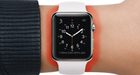 Man claimt brandwonden van Apple Watch